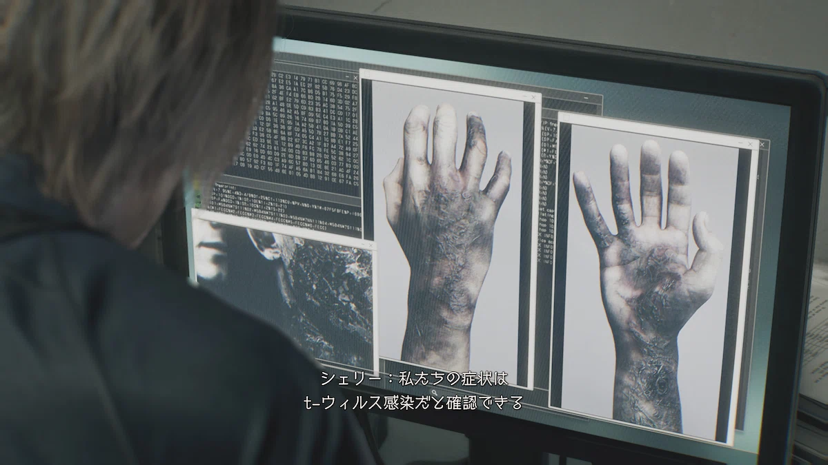 ラクーン症候群